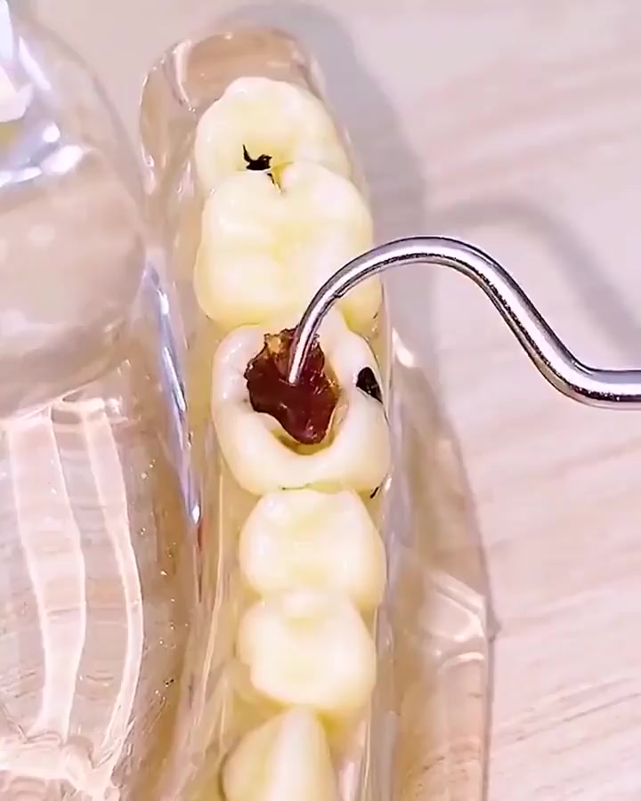 Stainless Steel Toothpick Set