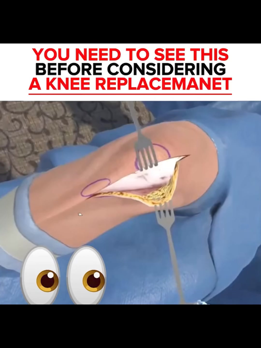 Kneefix™ - New ACI-Like Technology Helps Reverse Knee Cartilage Damage – Docas store ad creative